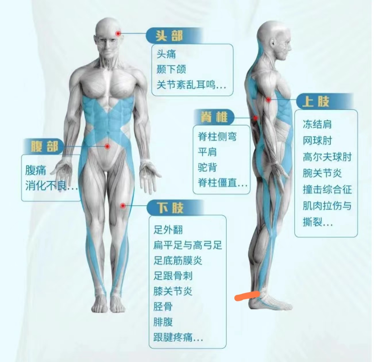 体态筋膜链评估示意
